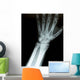 Xray Wrist Wall Decal