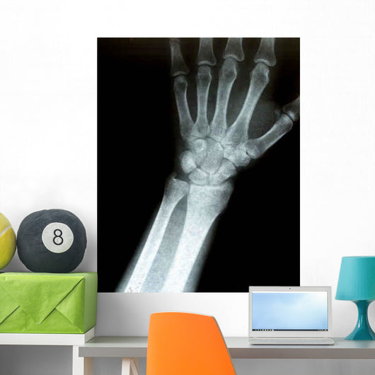 Xray Wrist Wall Decal
