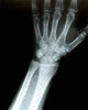 Xray Wrist Wall Decal