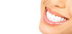 Woman Teeth