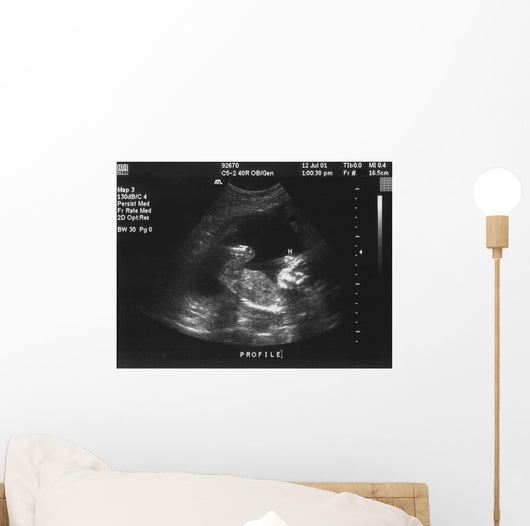 Baby Ultrasound Wall Mural