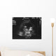 Baby Ultrasound Wall Mural