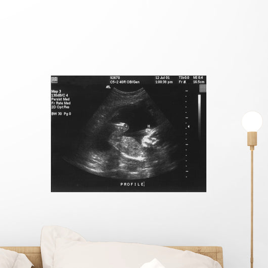 Baby Ultrasound Wall Mural