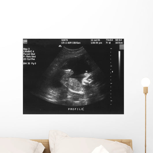 Baby Ultrasound Wall Mural