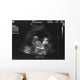 Baby Ultrasound Wall Mural