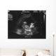 Baby Ultrasound Wall Mural