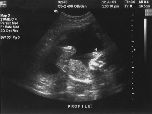 Baby Ultrasound Wall Mural