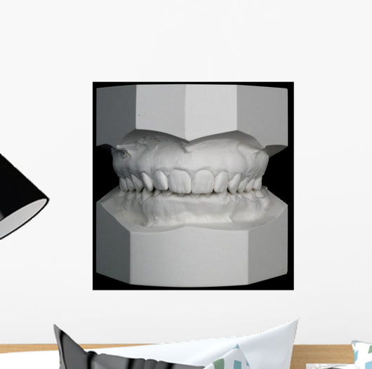Orthodontic Study Model