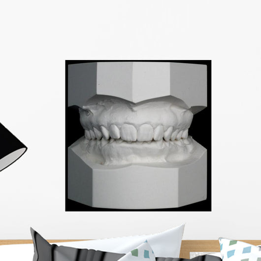 Orthodontic Study Model
