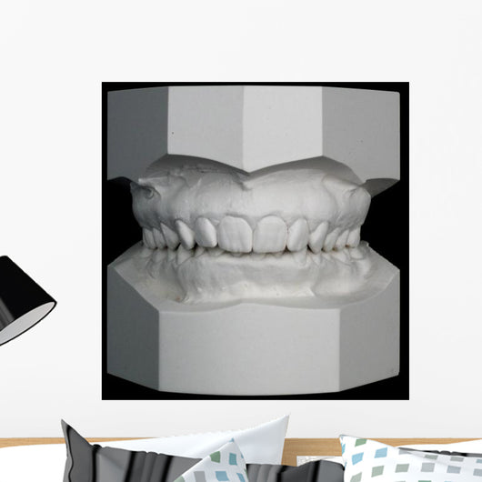 Orthodontic Study Model