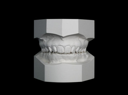 Orthodontic Study Model