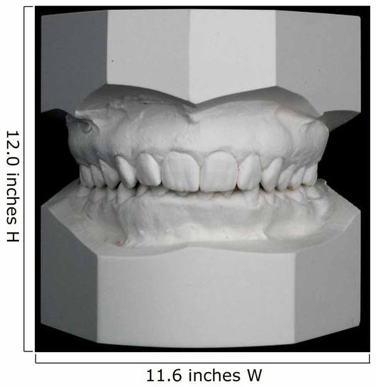 Orthodontic Study Model