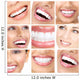 Teeth and Smile
