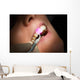 Dental laser dental gums Wall Mural