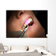 Dental laser dental gums Wall Mural