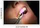Dental laser dental gums Wall Mural