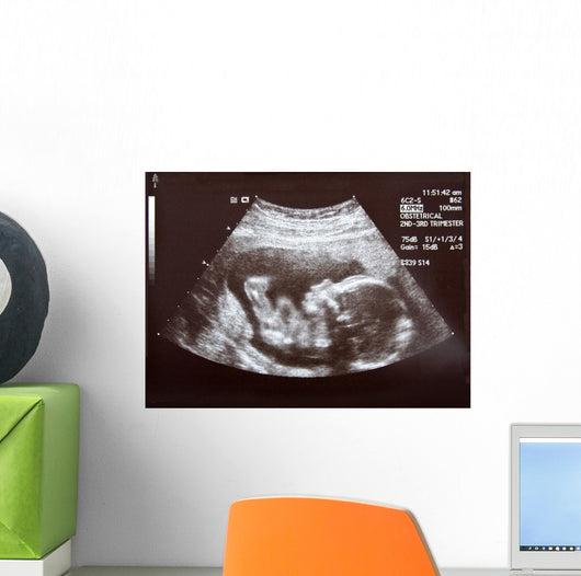 Ultrasound during Second Trimester Wall Mural
