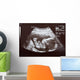 Ultrasound during Second Trimester Wall Mural