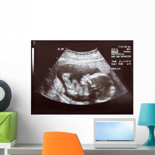 Ultrasound during Second Trimester Wall Mural