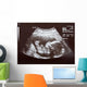 Ultrasound during Second Trimester Wall Mural