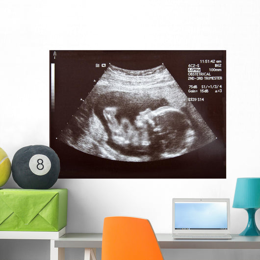 Ultrasound during Second Trimester Wall Mural