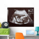 Ultrasound during Second Trimester Wall Mural