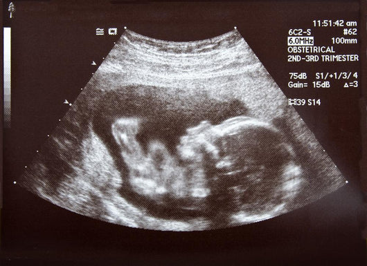 Ultrasound during Second Trimester Wall Mural