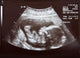 Ultrasound during Second Trimester Wall Mural