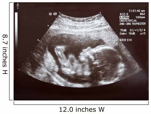 Ultrasound during Second Trimester Wall Mural