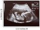 Ultrasound during Second Trimester Wall Mural