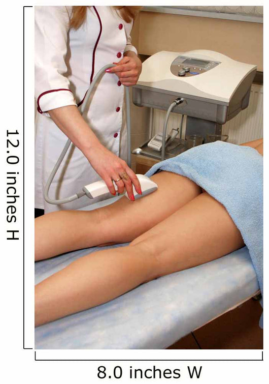 Laser Epilation