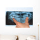 Dental X-Ray panoramic Wall Mural