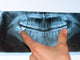 Dental X-Ray panoramic Wall Mural