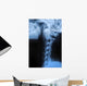 Human Bodys Radiograph