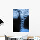 Human Bodys Radiograph