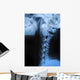 Human Bodys Radiograph