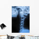 Human Bodys Radiograph