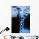 Human Bodys Radiograph