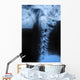 Human Bodys Radiograph