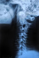 Human Bodys Radiograph