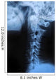 Human Bodys Radiograph