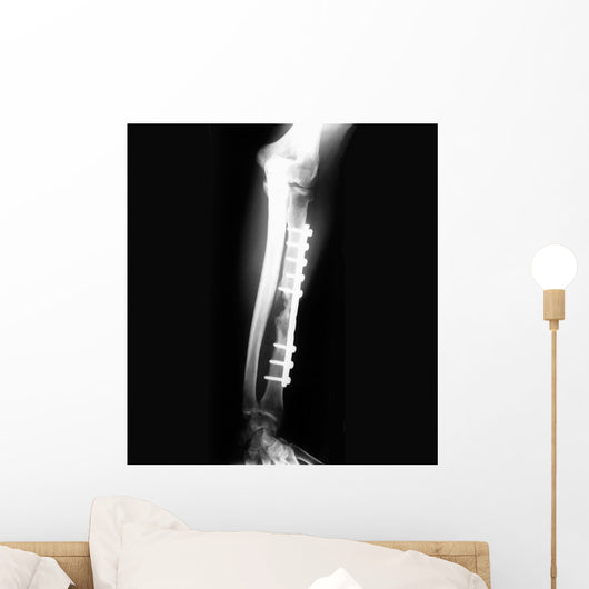 X-ray of Forearm Wall Mural