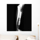 X-ray of Forearm Wall Mural