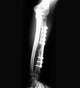 X-ray of Forearm Wall Mural