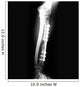 X-ray of Forearm Wall Mural