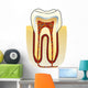 dente Wall Decal