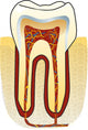 dente Wall Decal