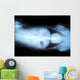 Animal X-ray