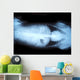Animal X-ray