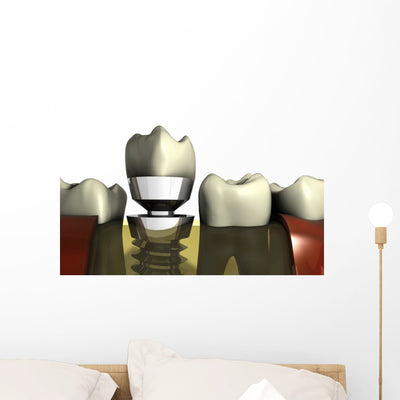 Dental Aesthetics shown on a wall
